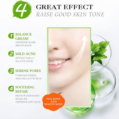 AICHUN BEAUTY Face Acne Cleaning Cream Skin Care Remove Repair Comedone Pimple Acne Face Acne Cream 30ml